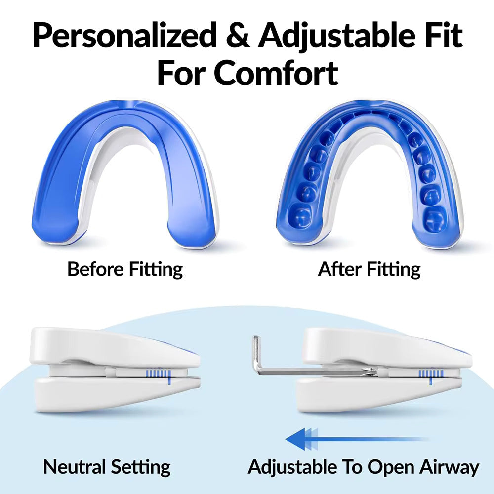 GuardFX — Custom-fit Adjustable Anti-Snoring Mouthpiece