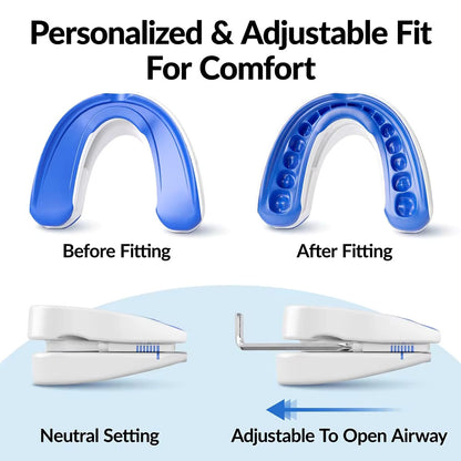 GuardFX — Custom-fit Adjustable Anti-Snoring Mouthpiece
